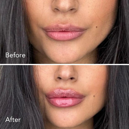 Wellivo - Magic Lip Stick Plumper